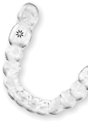 Aligners